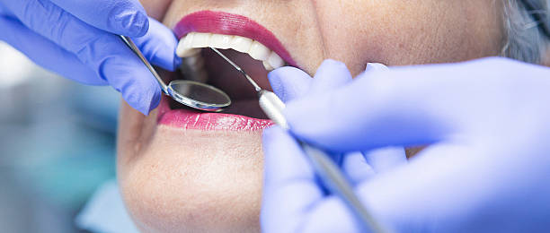 Best Emergency Dentist for Lost Fillings or Crowns in Greenville, MS